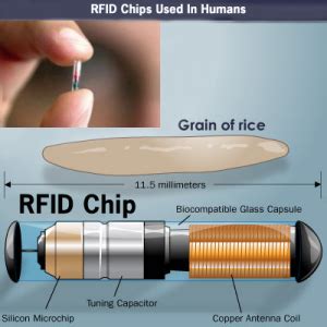 what is rfid chip obamacare|ObamaCare Implant: ObamaCare Microchip RFID Myth.